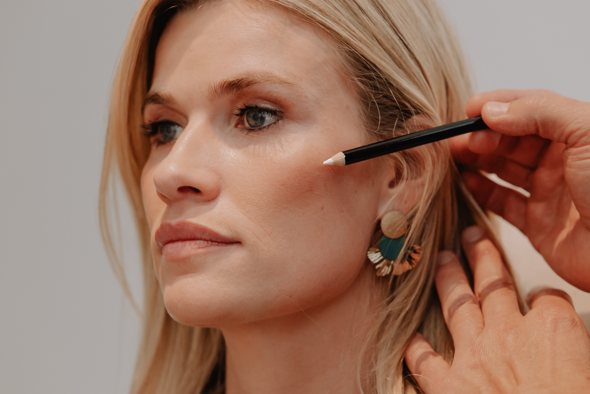 Aanvullende fillers voor V-shape herstel