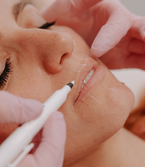 Lipfillers