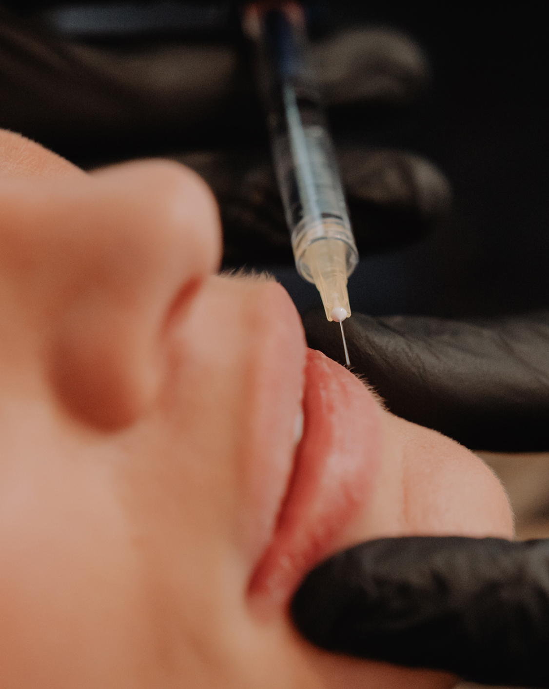 Skinject Clinic