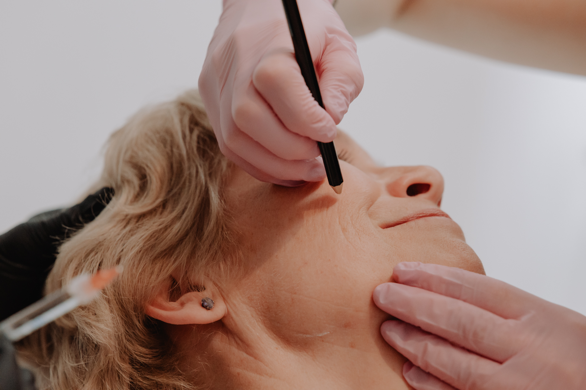 Fijne lijntjes wangen