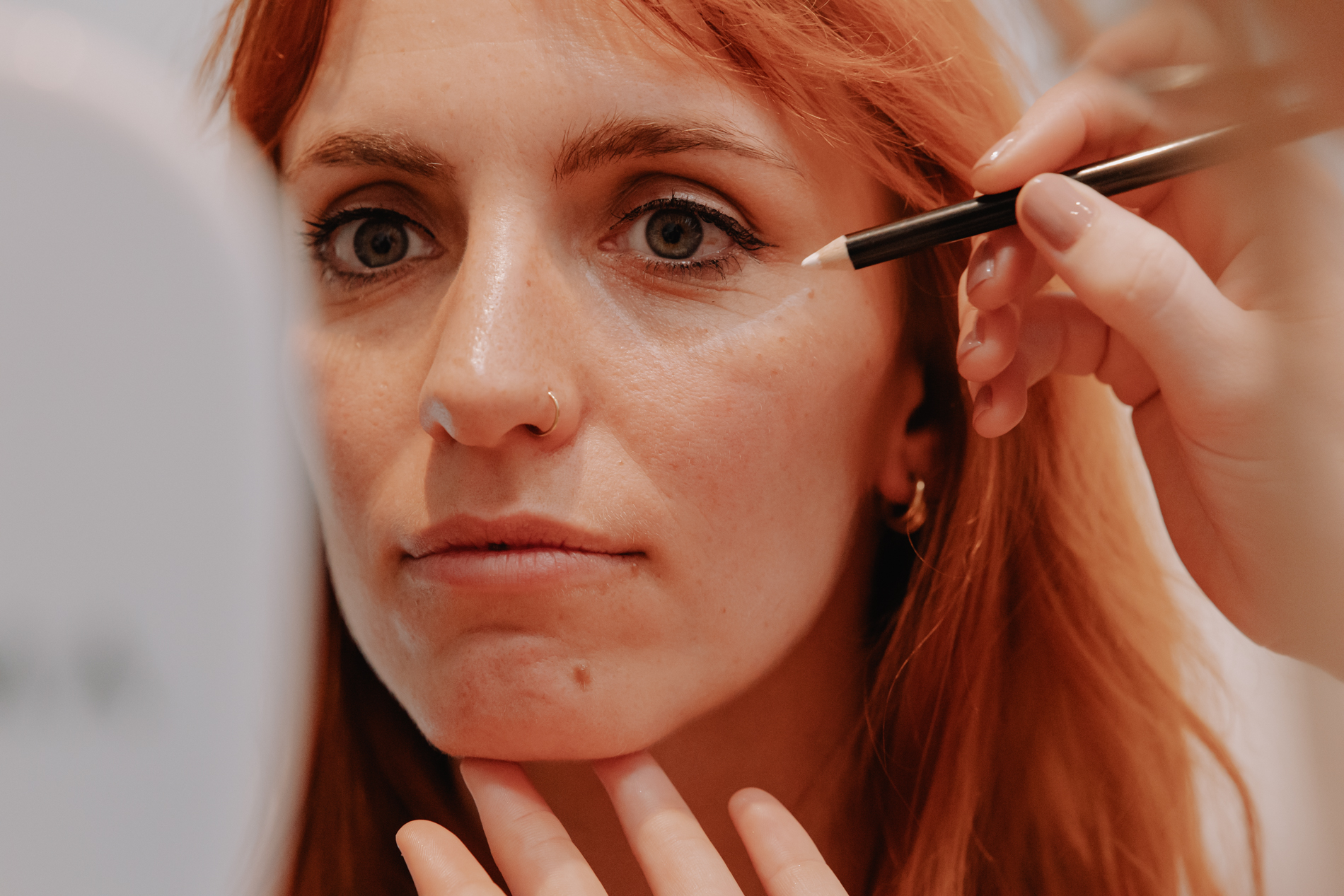 Behandeling wallen of donkere kringen bij Skinject Clinic in Waasmunster